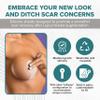 EpiDerm Areopexy Silicone Scar Sheets  Medical Grade Silicone Scar Tape for Breast Surgery  Reusable, Washable & Customizable Post Op Breast Reduction Essentials  Lollipop Shape Pair view 2
