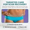 EpiDerm Long Strips Natural Silicone Scar Sheets  Soft, Flexible & Reusable Scar Sheets - Scar Treatment for Tummy Tuck, C-Section & Surgery Scars - Conforms to Body Contours - 1.4" x 11.5", 1 Pair view 2