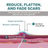 EpiDerm Long Strips Natural Silicone Scar Sheets  Soft, Flexible & Reusable Scar Sheets - Scar Treatment for Tummy Tuck, C-Section & Surgery Scars - Conforms to Body Contours - 1.4" x 11.5", 1 Pair view 4